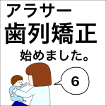 アラサー歯列矯正始めました。6